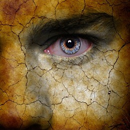 干眼症怎么治疗,怎么防止得干眼症 干眼症怎么治疗,怎么防止得干眼症