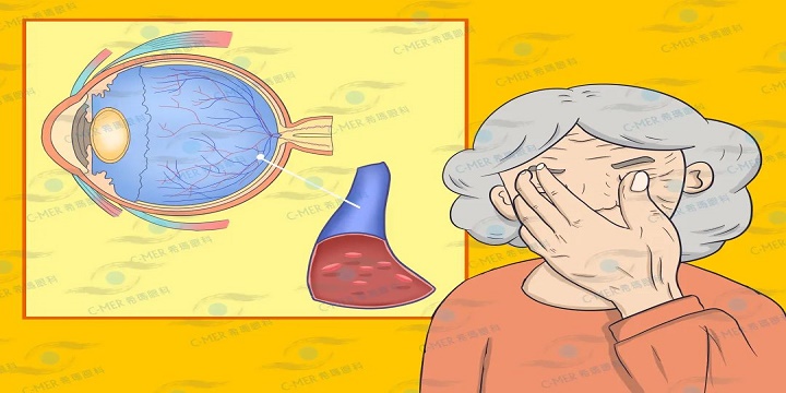 高血压引发眼病 高血压引发眼病
