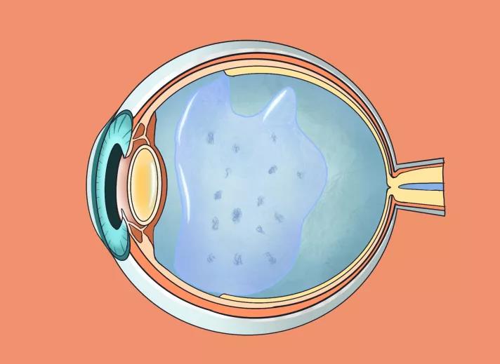 珠海儿童近视医院,珠海儿童近视防控中心,珠海希玛林顺潮眼科医院 珠海儿童近视医院,珠海儿童近视防控中心,珠海希玛林顺潮眼科医院