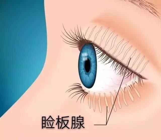 眼睛干涩如何解决,眼睛干得厉害怎么治疗,眼睛干涩用什么药 眼睛干涩如何解决,眼睛干得厉害怎么治疗,眼睛干涩用什么药