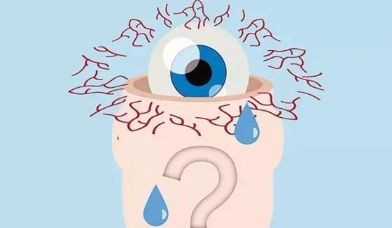 眼睛干涩如何解决,眼睛干得厉害怎么治疗,眼睛干涩用什么药 眼睛干涩如何解决,眼睛干得厉害怎么治疗,眼睛干涩用什么药