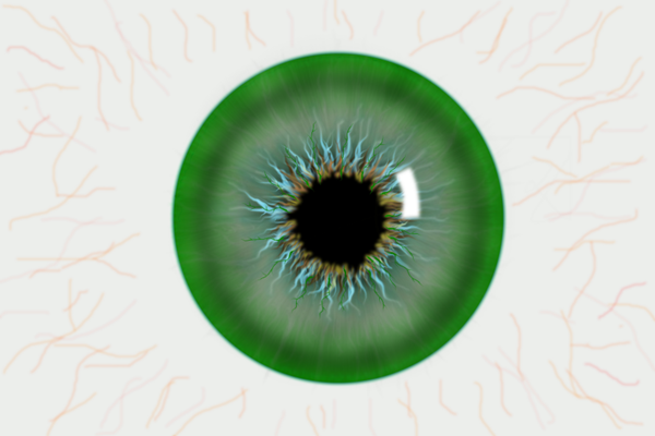 青光眼,高眼压性青光眼,青光眼诊断,珠海希玛眼