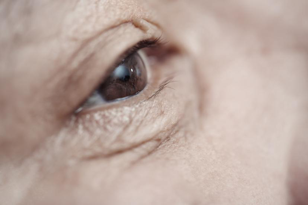 青光眼怎么治疗,治疗青光眼的方法,青光眼治疗办法